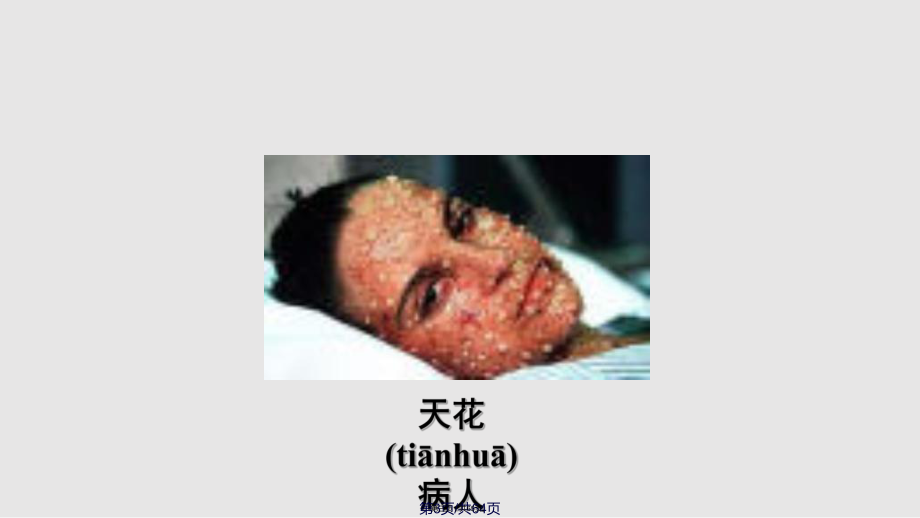 传染病流行病学我们正处于一场传染性疾病全球危机的边缘实用教案_第3页