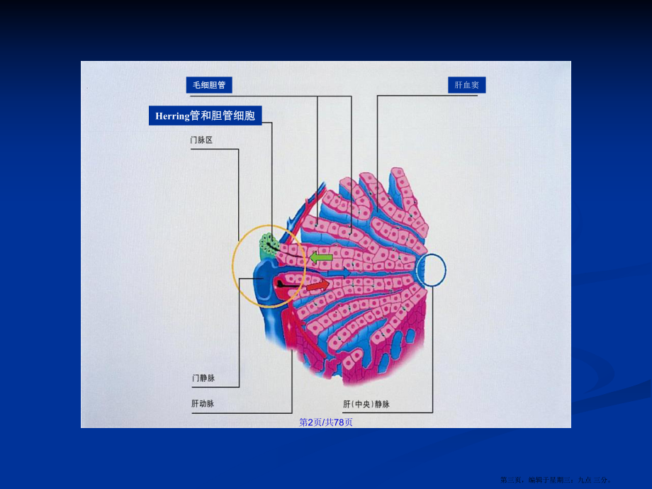 黃疸的診斷和治療學(xué)習(xí)教案_第3頁