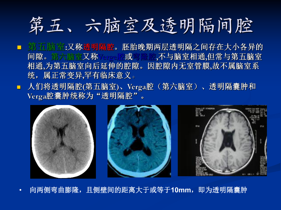 脑室系统及脑脊液循环_第3页