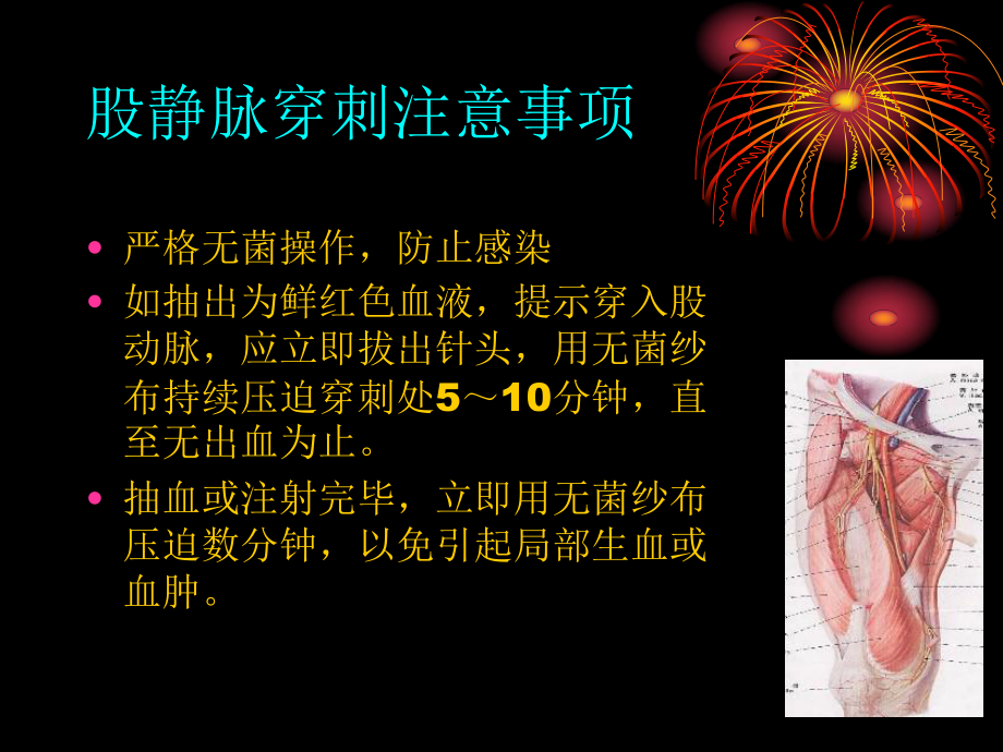 股静脉置管护理._第3页