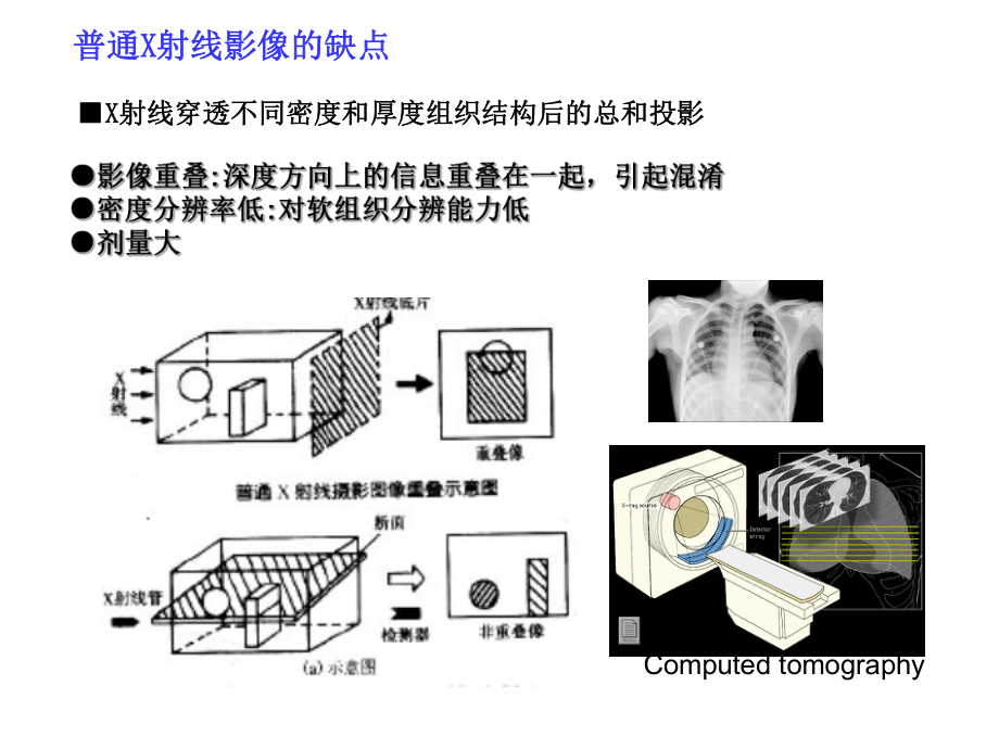 X-CT成像原理_第2頁