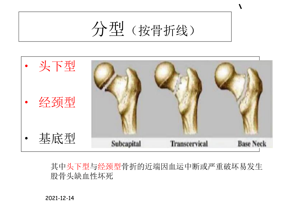 股骨頸骨折的護(hù)理_第4頁