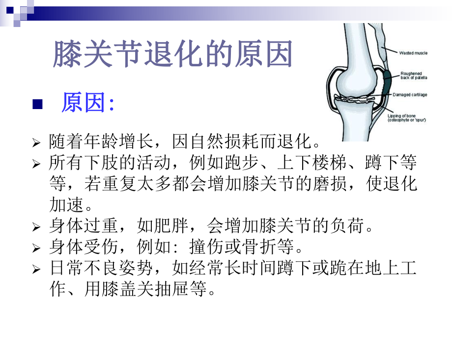 退化性膝关节炎的康复治疗_第5页