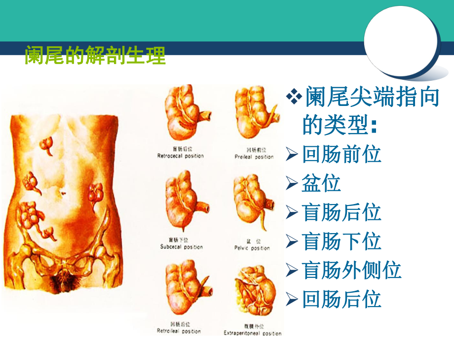 阑尾炎病人的护理详解教学文案_第5页