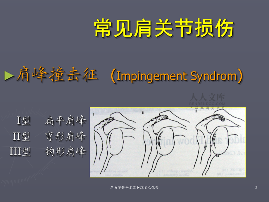 肩關節(jié)鏡手術期護理要點優(yōu)秀課件_第2頁