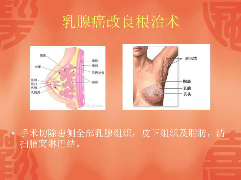 精彩乳癌患者術(shù)后患肢功效康復(fù)課件_第5頁