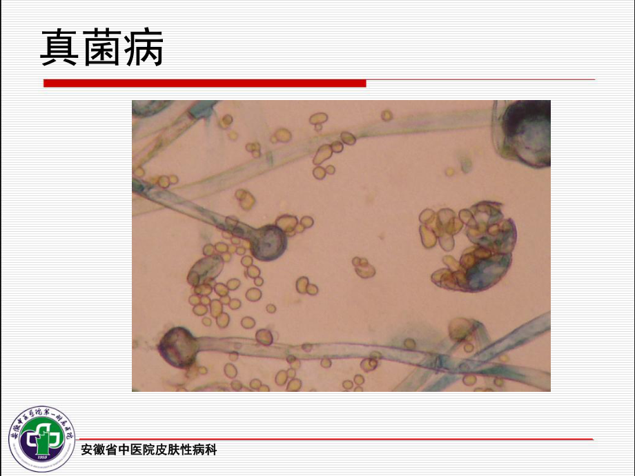 皮肤病实验室检查 ppt课件_第4页