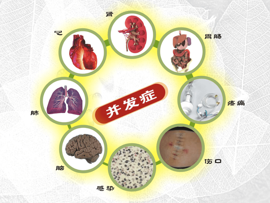 “金马”液体治疗与手术预后[优质课件_第3页