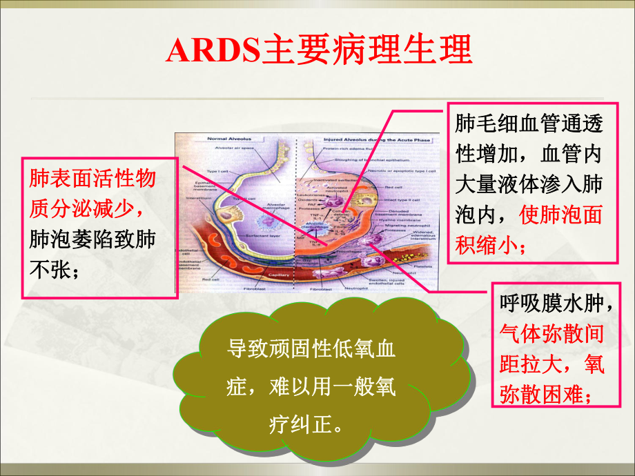 急性呼吸窘迫綜合征診治現狀及思考(2012.122濟南)_第3頁