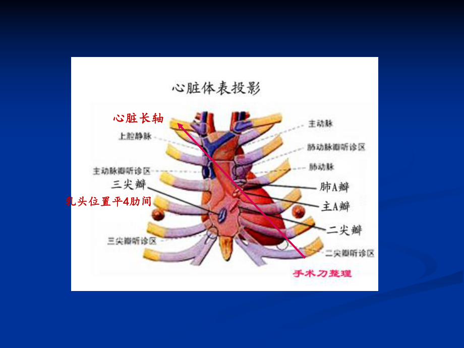 心臟超聲常規(guī)切面及手法操作_第3頁