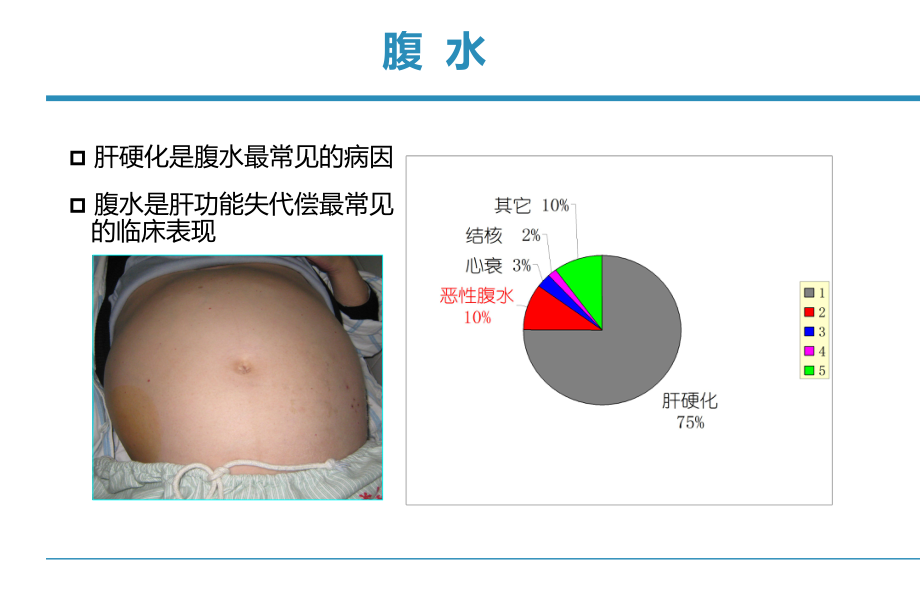 肝硬化腹水管理 20120418_第3页