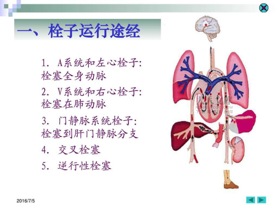 局部血液循環(huán)障礙圖文ppt課件_第2頁