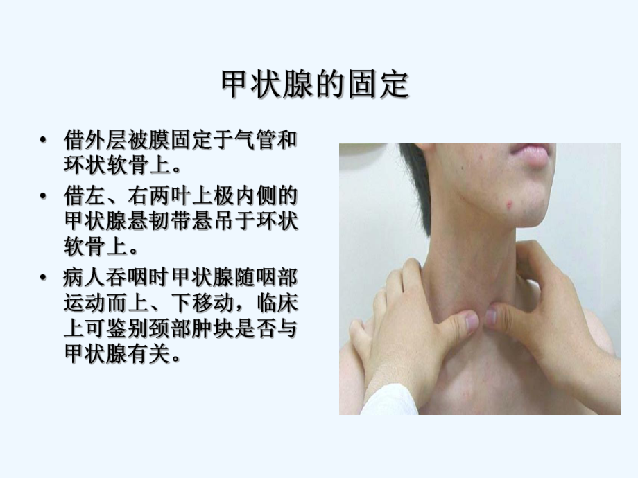 甲狀腺疾病教學(xué)課件_第5頁