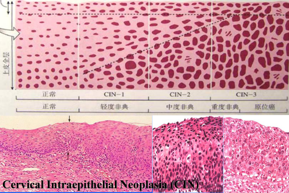 病理課件期中前neoplasia part_第5頁