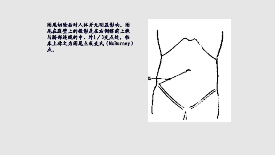 概念肠痈是指发生在肠道的痈肿_第3页