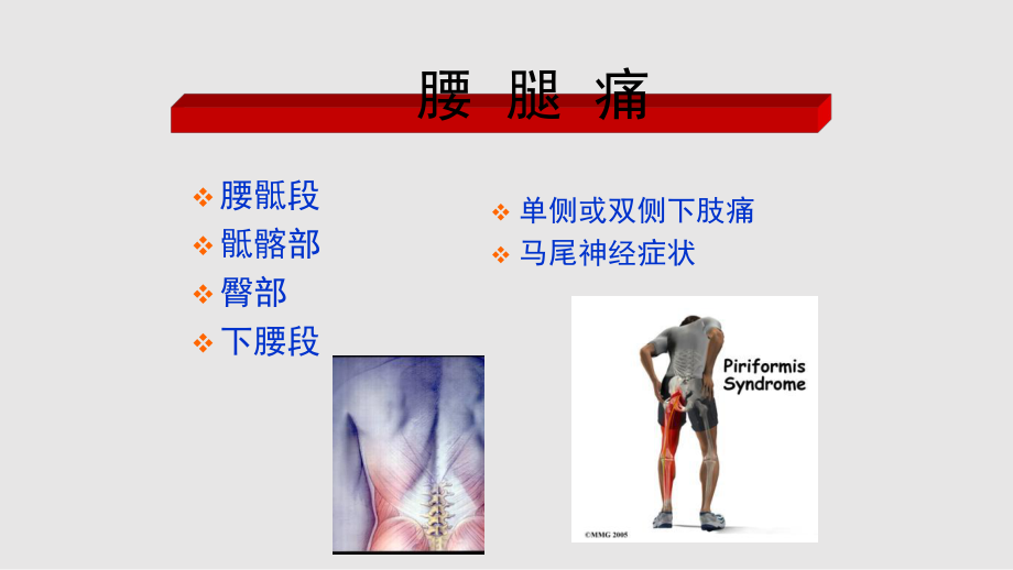 頸肩痛與腰腿痛_第4頁