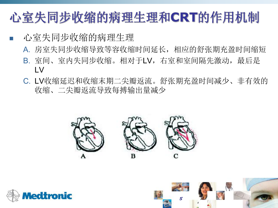 CRT適應證的評價_第5頁