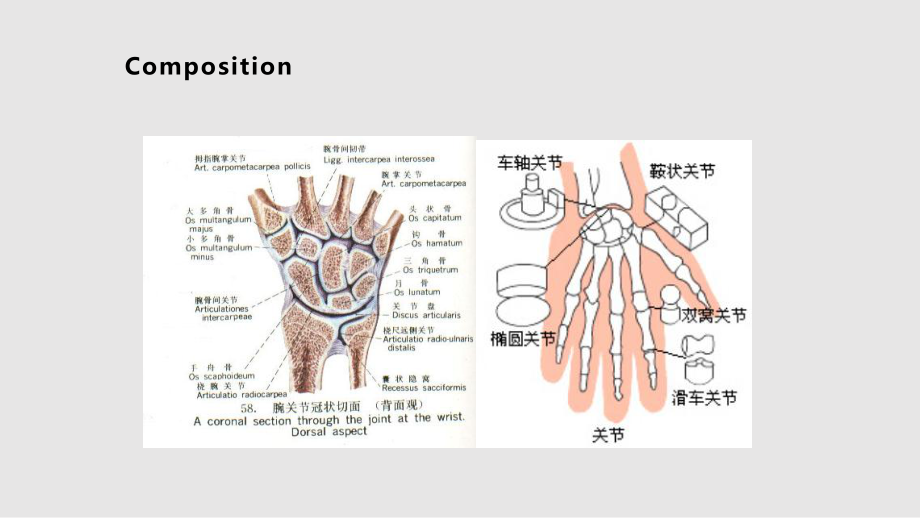 陈旧性bennett骨折的处理_第3页