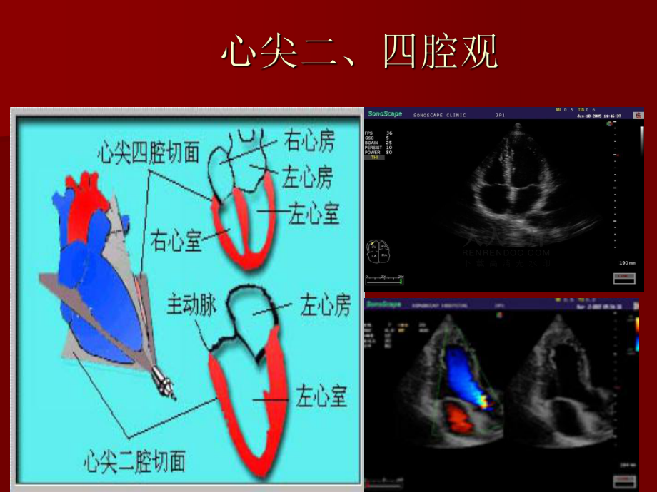 超聲心動(dòng)圖入門(mén)基礎(chǔ)第二部分_第2頁(yè)