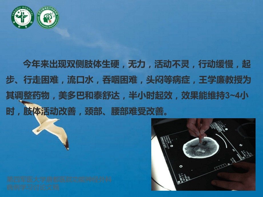腦起搏器治帕金森病的手術(shù)時(shí)機(jī)把握ppt課件_第3頁(yè)