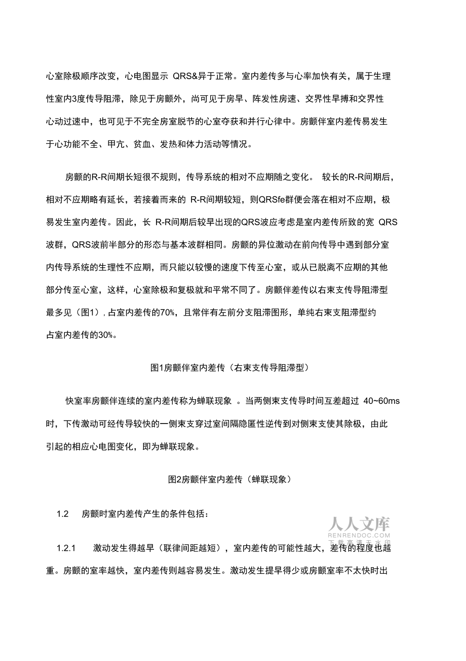 房颤伴室内差传与房颤伴室早的鉴别_第2页