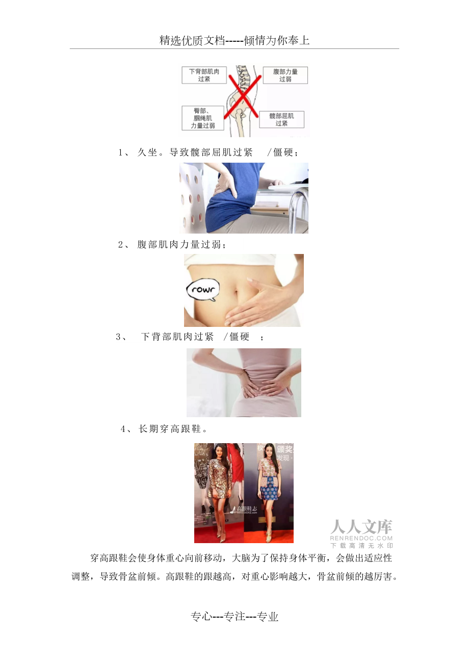 是翘臀还是骨盆前倾_第2页