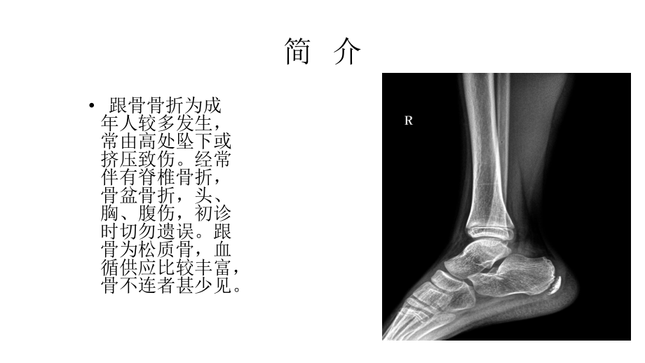 跟骨骨折患者的护理查房_第3页