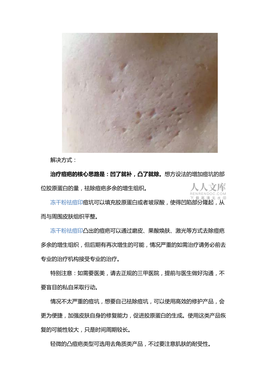 曾经手贱留下的痘印冻干粉祛痘印如何才能有效去除_第2页
