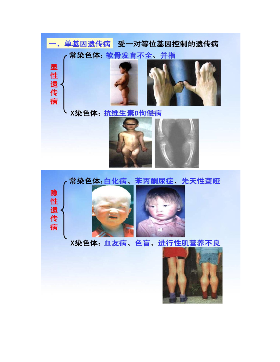 【图文】人类遗传病PPT演示文稿_第3页