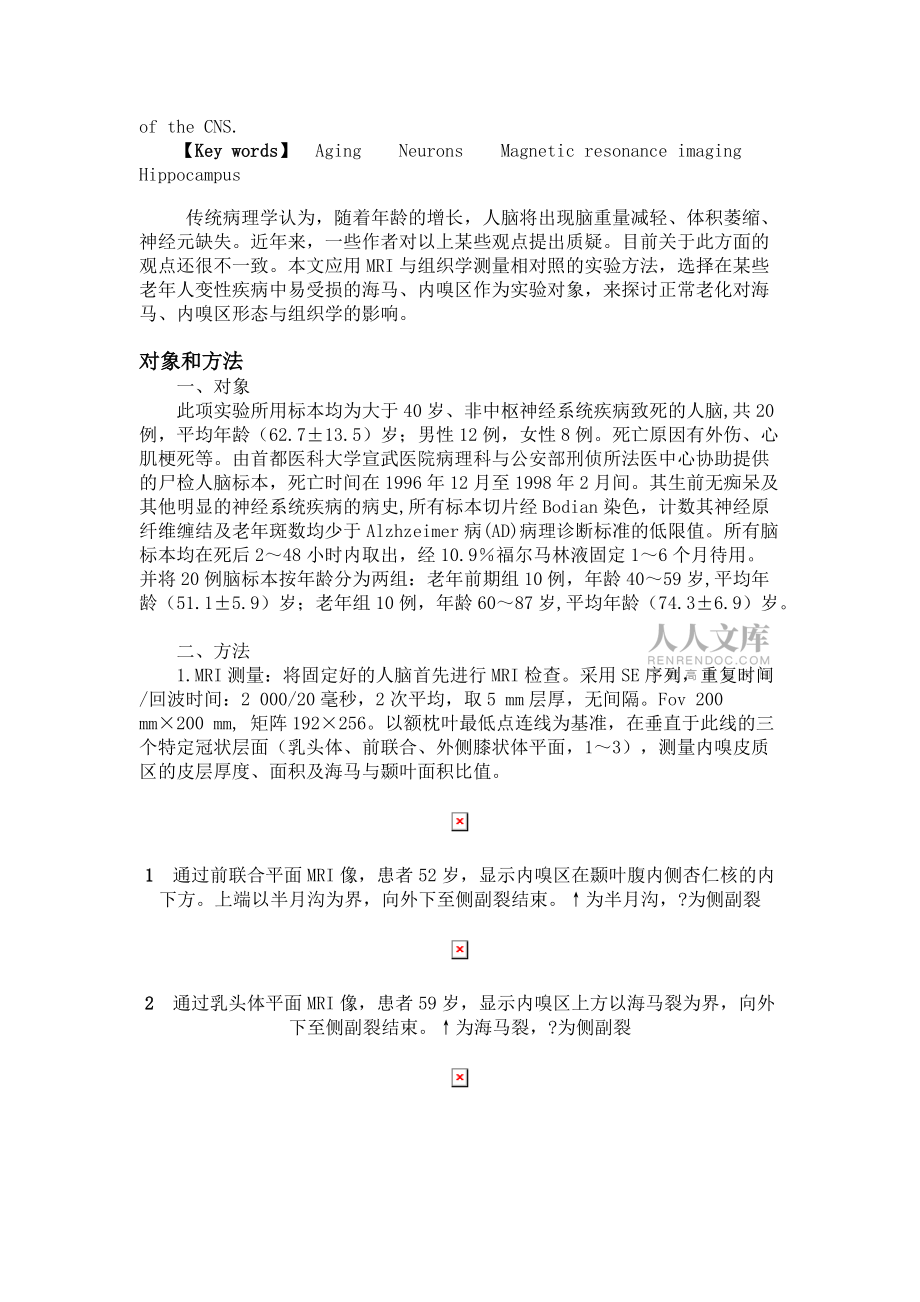 正常老年人及老年前期海马、内嗅区MRI与组织学的研究_第2页