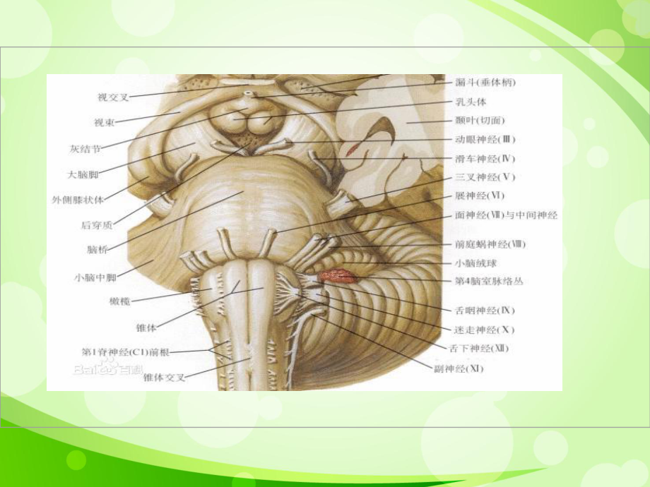 動眼神經麻痹常見病因_第4頁