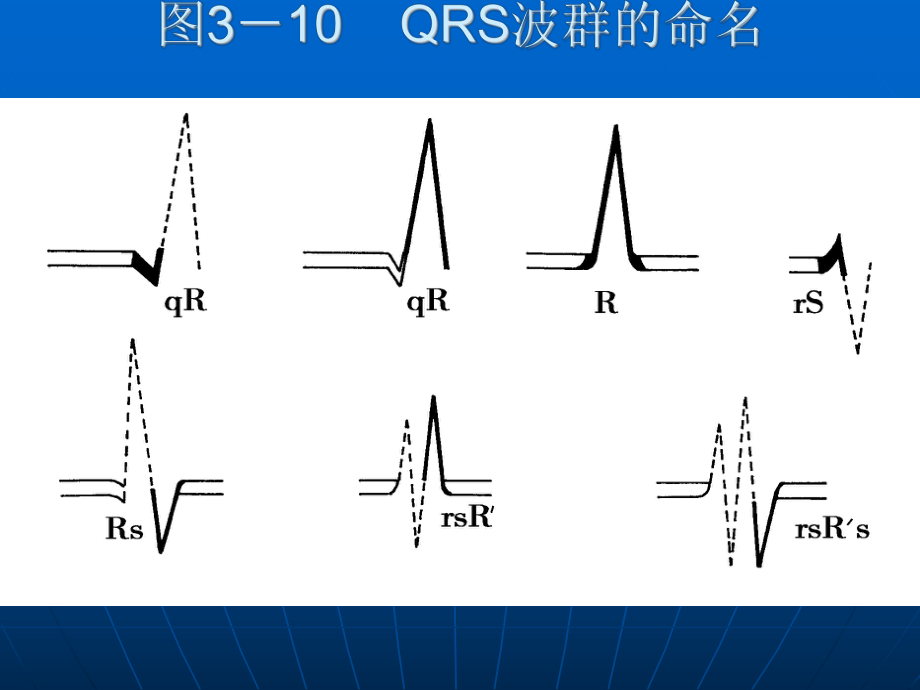 心肌细胞动作电位与心电图的关系_第5页