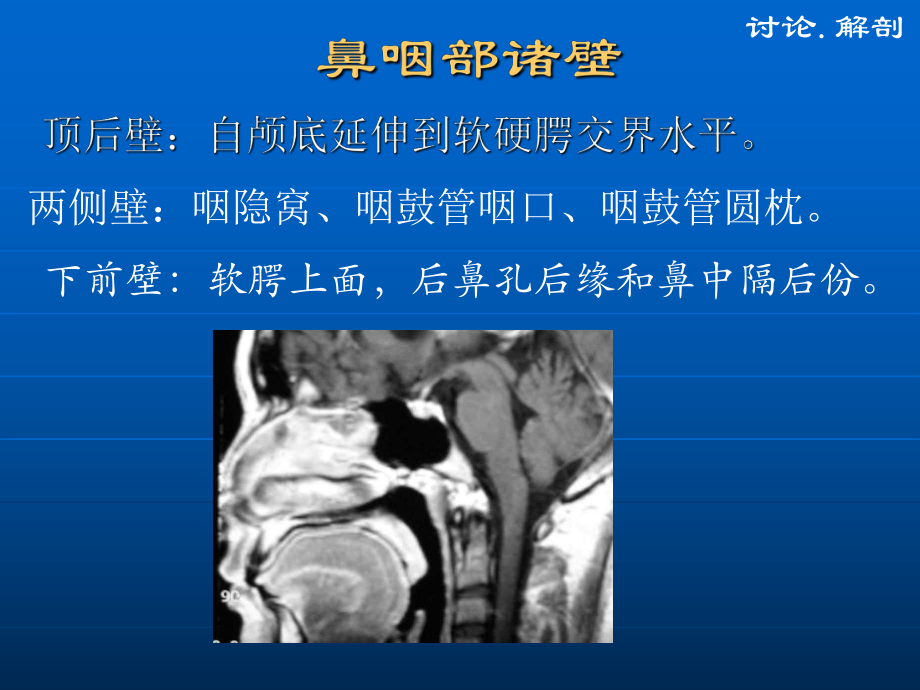鼻咽癌CT與MR診斷_第3頁